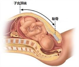 宫高是指从下腹耻骨联合处到子宫底的长度,是判断子宫大小的数据之一