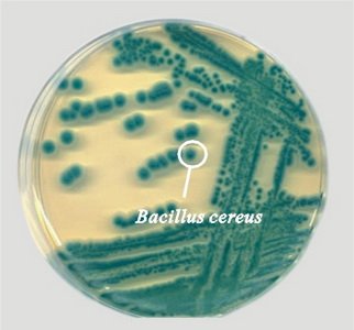 基本信息 中文学名:蜡样芽孢杆菌       二名法:bacillus cereus