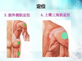 肌内注射_360百科