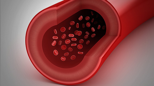 小儿动脉导管未闭_360百科