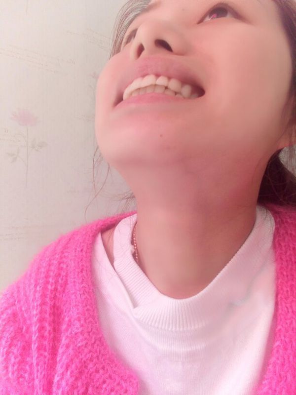 你们知道哪里正牙好吗,我的上排牙齿有点突出