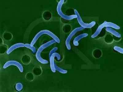 海洋致病细菌,与霍乱弧菌,肠炎弧菌并列为造成人类感染疾病的三大弧菌